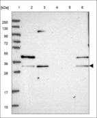 Anti-RNASEH2A Antibody