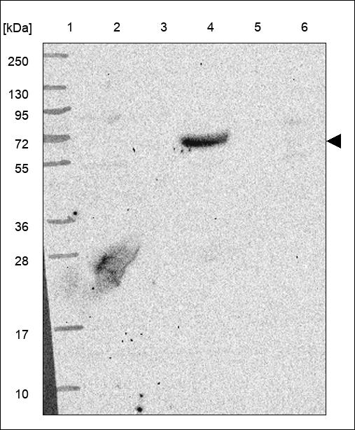 Anti-CYP11B1 Antibody
