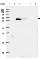 Anti-NCSTN Antibody