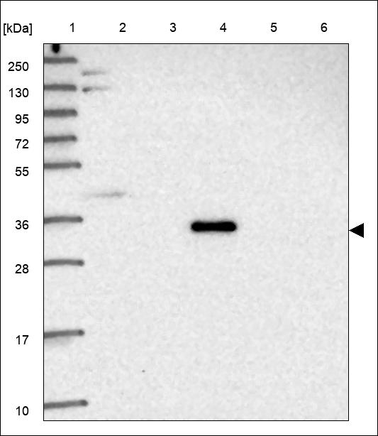 Anti-CCDC188 Antibody