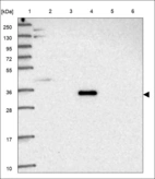 Anti-CCDC188 Antibody