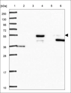 Anti-ZNF829 Antibody