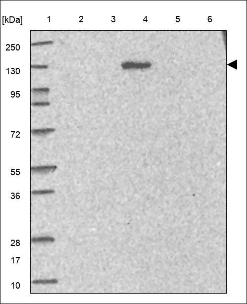 Anti-RTEL1 Antibody