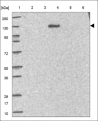 Anti-RTEL1 Antibody
