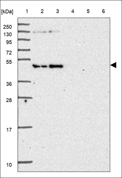 Anti-CLPTM1L Antibody