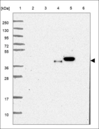 Anti-FAM166A Antibody