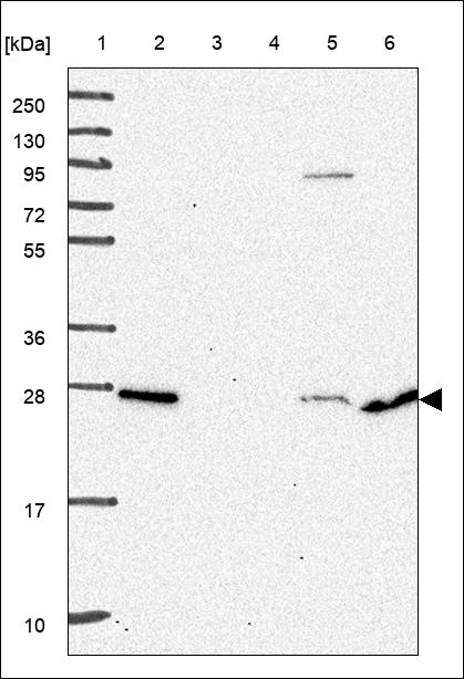 Anti-AKIP1 Antibody