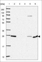 Anti-AKIP1 Antibody
