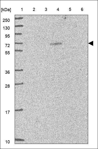 Anti-TRPV5 Antibody