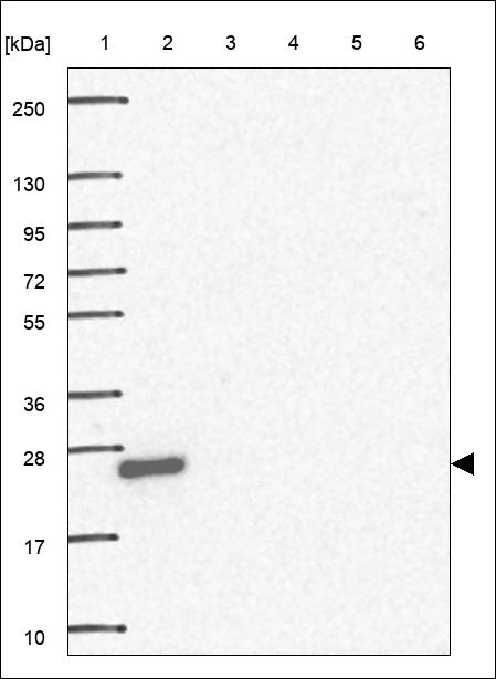 Anti-ROPN1B Antibody
