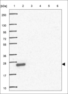 Anti-ROPN1B Antibody