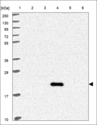 Anti-IZUMO1R Antibody