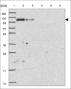 Anti-ZNF687 Antibody