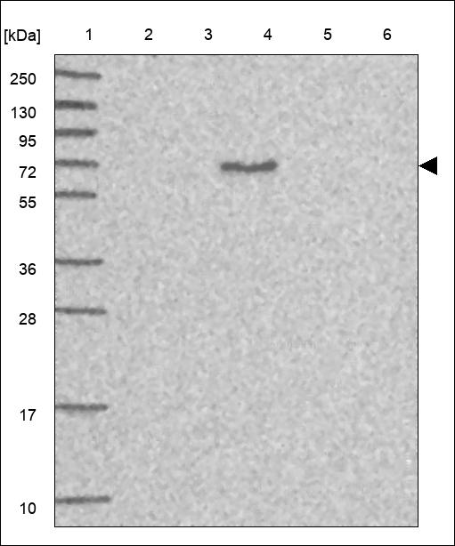 Anti-KLHL6 Antibody