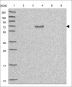 Anti-KLHL6 Antibody