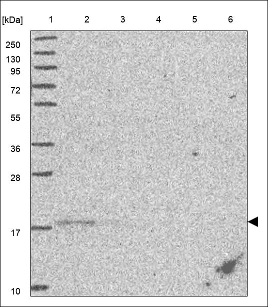 Anti-TRAPPC2 Antibody