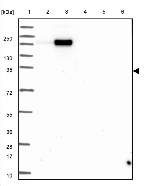 Anti-PLOD2 Antibody