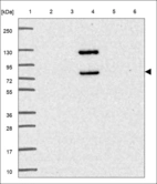 Anti-RABGGTA Antibody