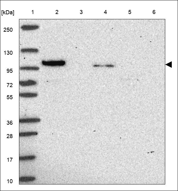 Anti-PPP1R12C Antibody