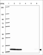 Anti-SRP9 Antibody