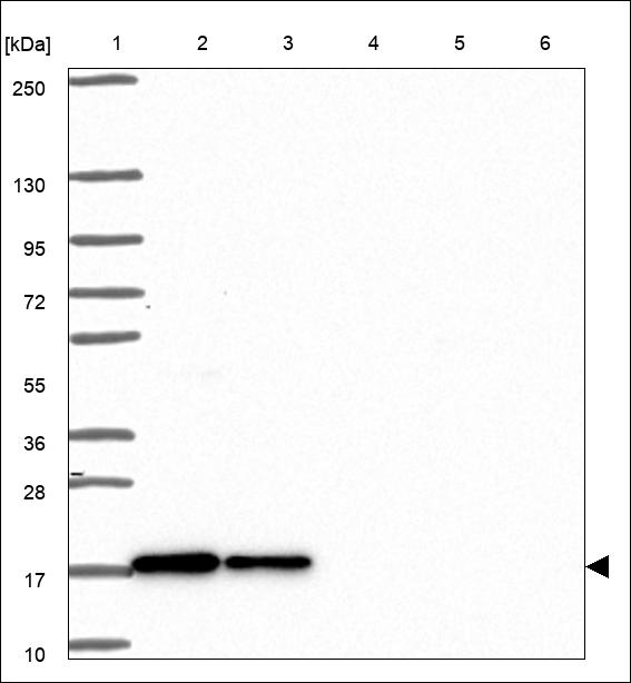 Anti-SRP14 Antibody