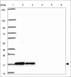 Anti-SRP14 Antibody