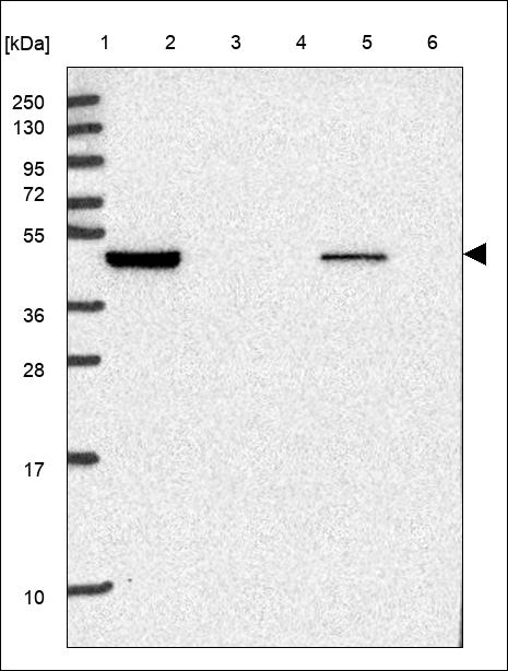 Anti-KLF10 Antibody