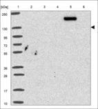 Anti-ULK1 Antibody