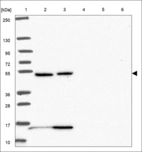 Anti-CHRNA7 Antibody