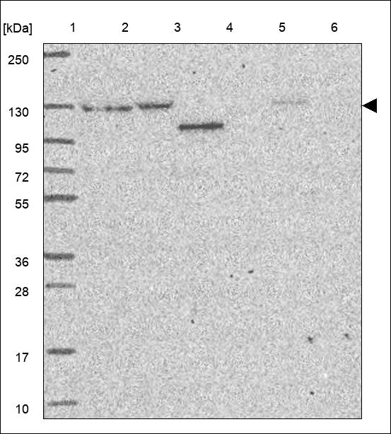 Anti-FANCD2 Antibody