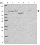Anti-FANCD2 Antibody