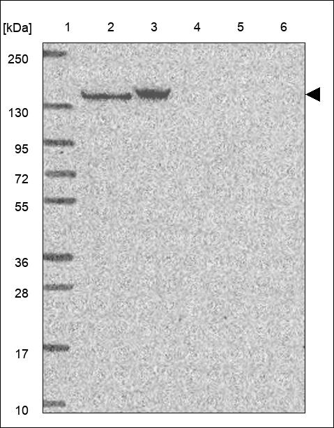 Anti-VARS1 Antibody