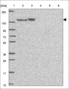 Anti-VARS1 Antibody