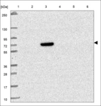 Anti-C8A Antibody