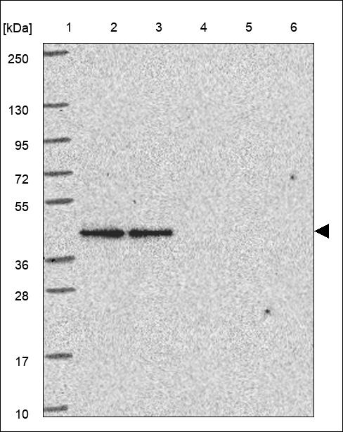 Anti-NDUFAF5 Antibody