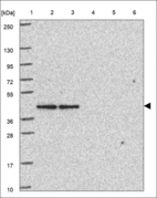 Anti-NDUFAF5 Antibody