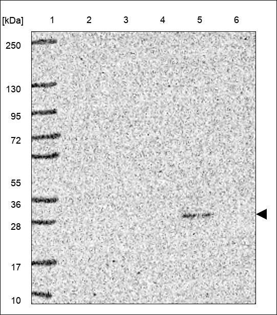 Anti-CLDN14 Antibody
