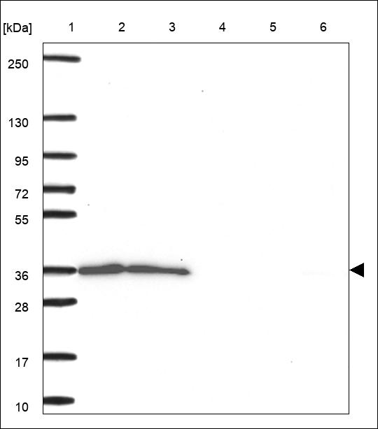 Anti-RTRAF Antibody