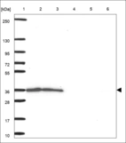 Anti-RTRAF Antibody
