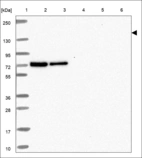 Anti-ABCC3 Antibody