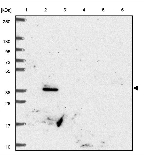 Anti-UFD1 Antibody