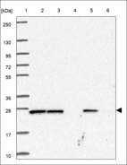 Anti-EMC8 Antibody