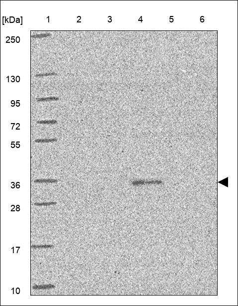 Anti-OR2Y1 Antibody
