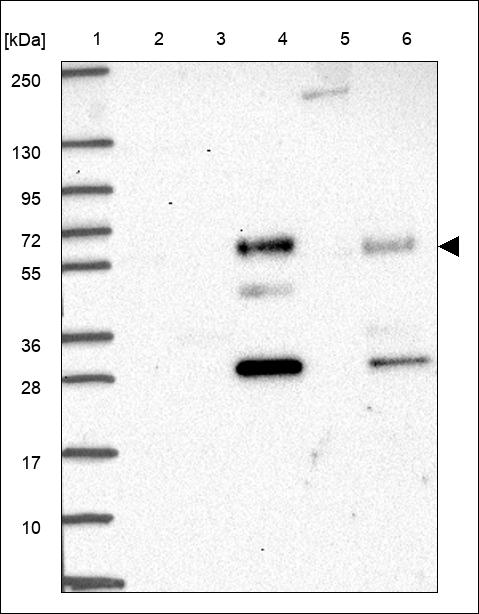 Anti-PPP1R16B Antibody