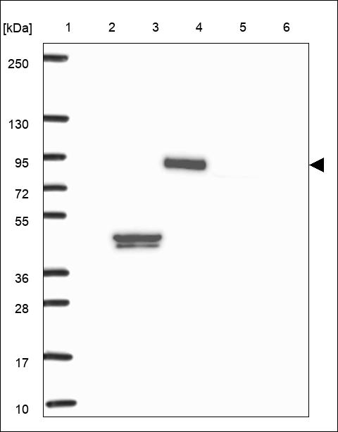 Anti-F11 Antibody