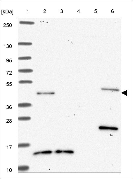 Anti-FST Antibody