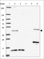 Anti-FST Antibody