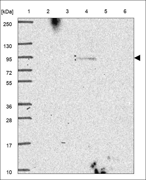 Anti-TRPC1 Antibody