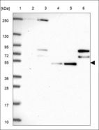 Anti-ASL Antibody