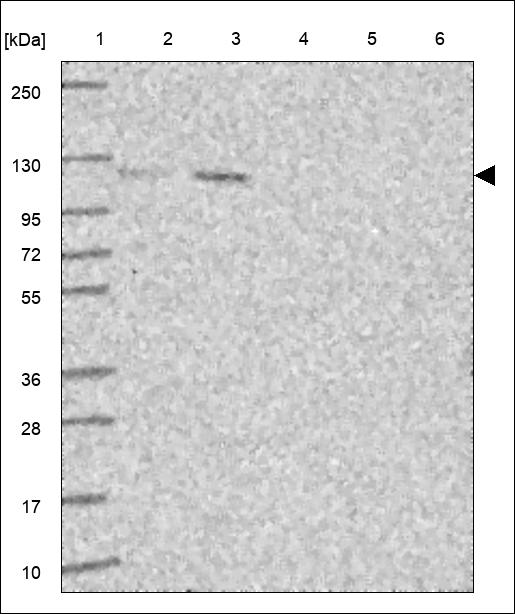 Anti-UBE3C Antibody